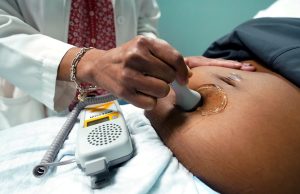 Louisiana bill seeks ‘fairness’ in pregnancy costs